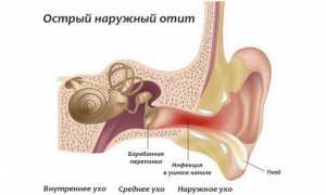 Причины, по которым немеют уши и лечение