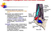 Синдром передней лестничной мышцы: симптомы и лечение скаленус-синдрома