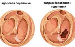 Кровяные выделения при проведении ушных гигиенических процедур: причины и первая помощь