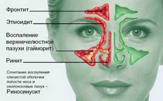 Когда и как применяются антибиотики в терапии фронтита?