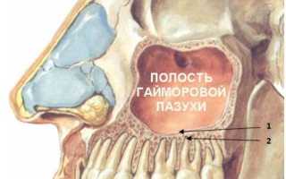 Связан ли гайморит с гигиеной полости рта?