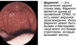 Инструкция по применению Гексаспрея