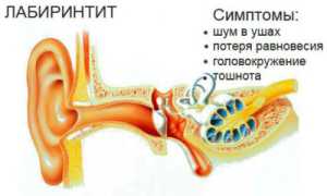 Какие препараты в форме капель используют при детском отите?