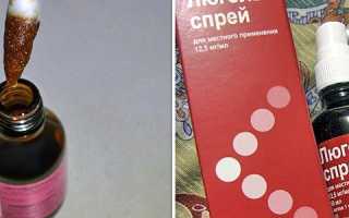 Помогает ли Люголь при ангине и как его использовать детям и взрослым?