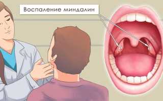 Чем отличается ринит от синусита?