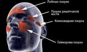 Основные причины и неблагоприятные факторы развития гайморита