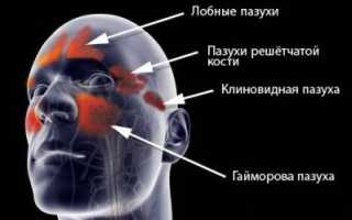 Основные причины и неблагоприятные факторы развития гайморита