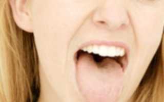 Что вызывает сухость во рту и жжение языка? Причины и устранение симптомов