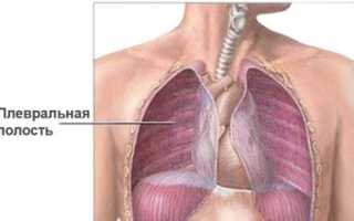 Плеврит легких у взрослых