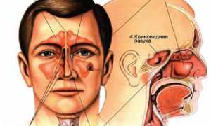 Гайморовы пазухи: анатомия, симптомы воспаления, рентгенография