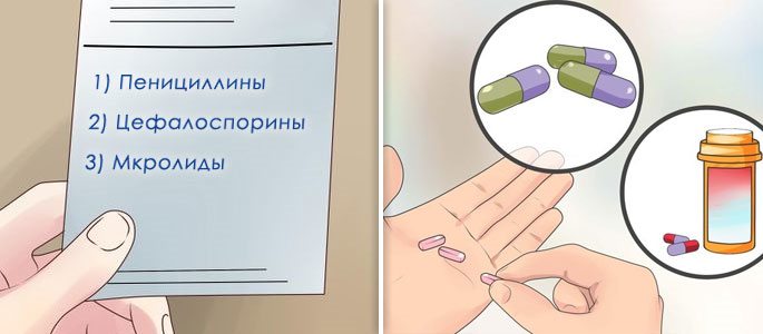 Антибактериальные препараты группы: пенициллинов, цефалоспоринов, макролидов