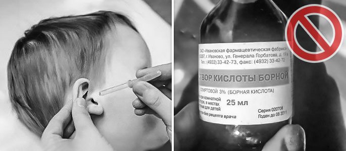 Закапывать в уши детям борный спирт противопоказано