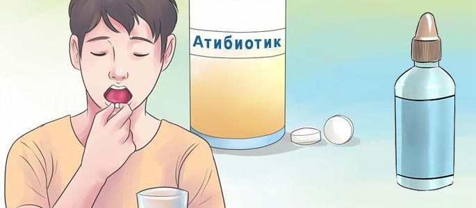 Медикаментозное лечение