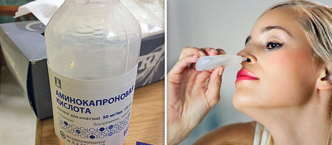 Капаем аминокапроновый раствор в нос