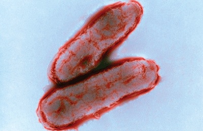 Haemophilus influenzae