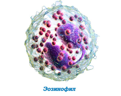 эозинофил