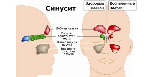Как проявляется