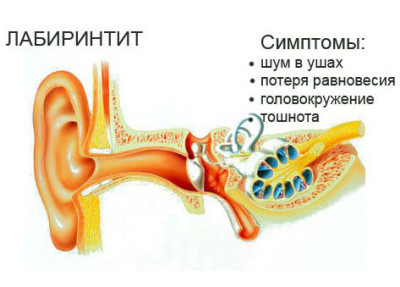 отит