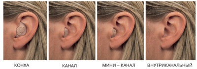 слуховые аппараты