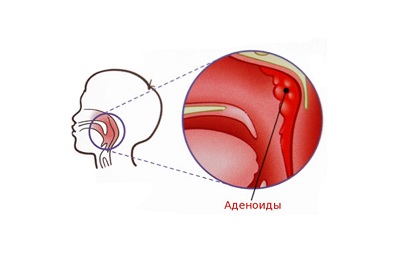 Как они выглядят