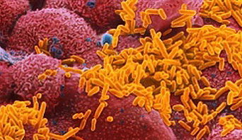 Haemophilus influenzae