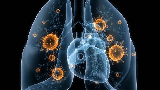 fabrika-formatovlungs-viruses-bacteria-disease