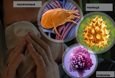 Аллергический ринит