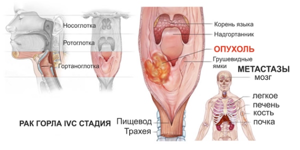 Четвертая стадия
