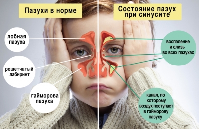 Что происходит при болезни