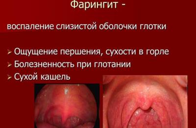 Что собой представляет болезнь