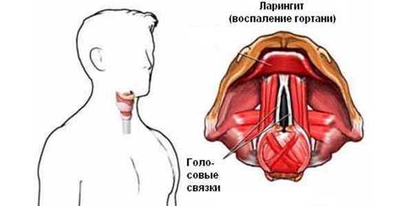 Что собой представляет патология?