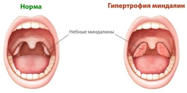 Как может выглядеть болезнь