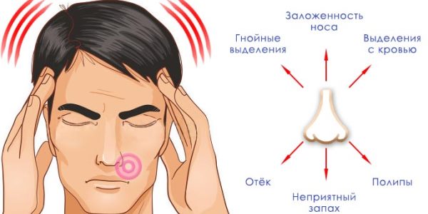 Как проявляется Мицетома