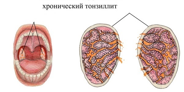 Как проявляется