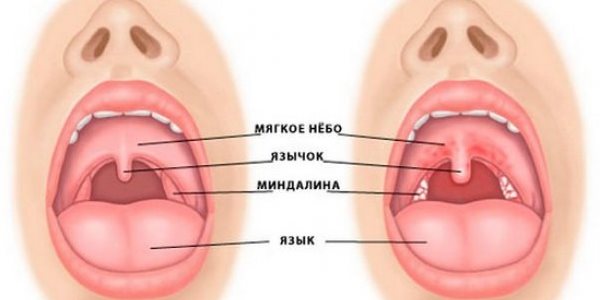 Как увидеть патологию