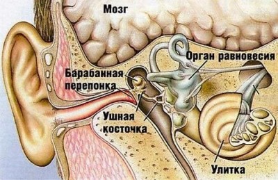 лабиринтит