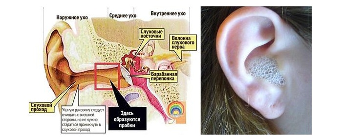 Как действует перекись