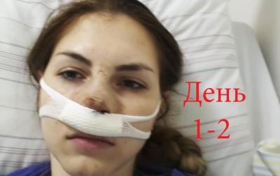 1-2 день