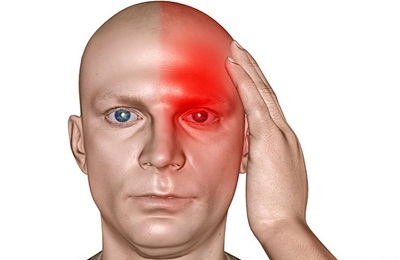 Головная боль
