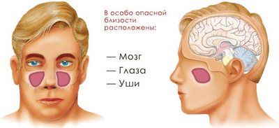 Осложнения
