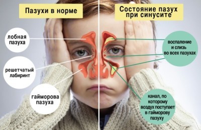 Наглядная схема