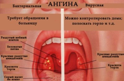 Обращение за помощью