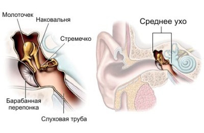 отит