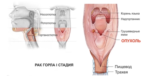 Первая стадия