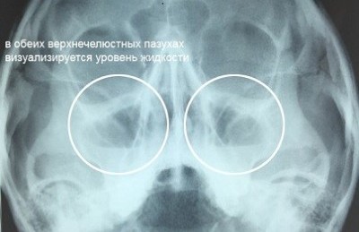 podborodochnaya-proekciya