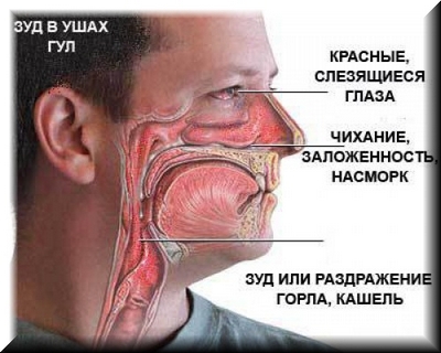Симптомы