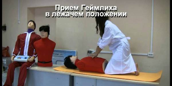 Прием Геймлиха лежа