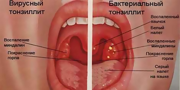 Пример патологии