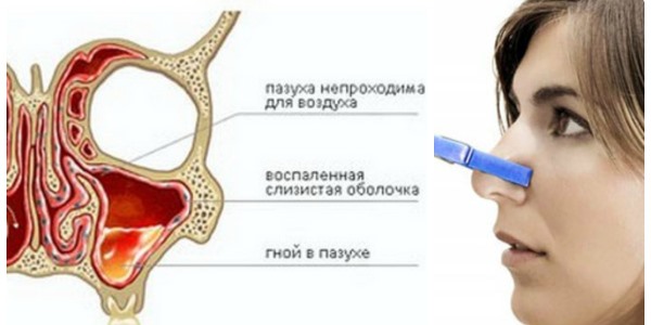 Пример заболевания