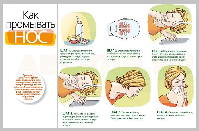 техника промывания носа